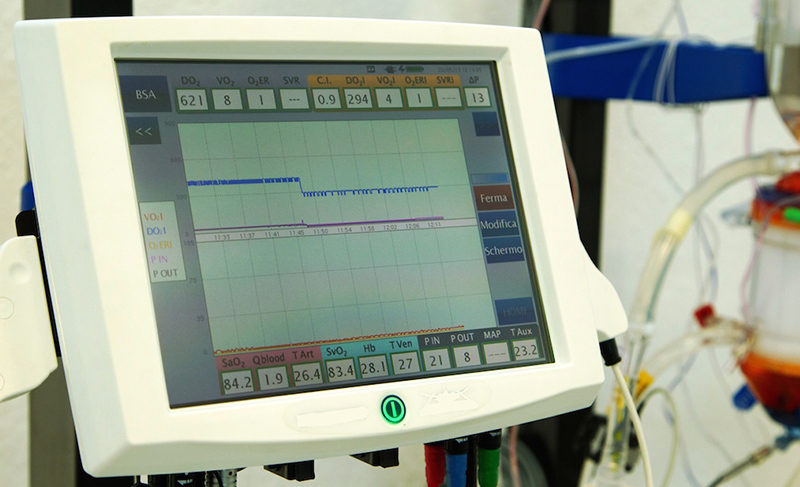 Sistema de monitorización electrónica para quirófanos